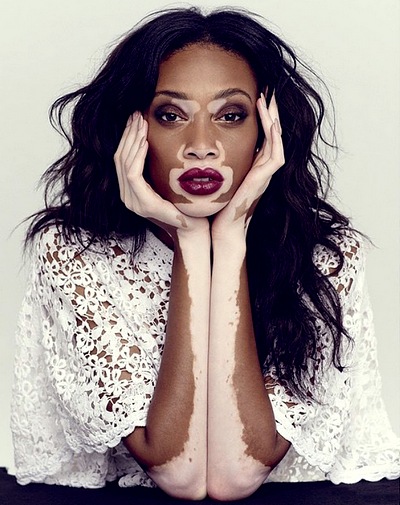 Winnie-harlow2.jpg