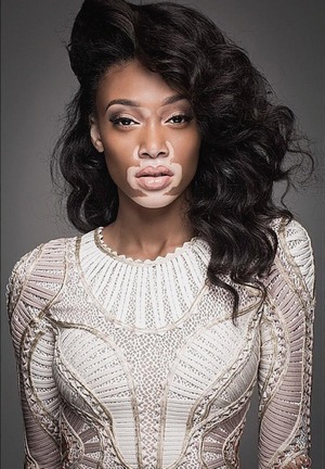 Winnie-harlow.jpg