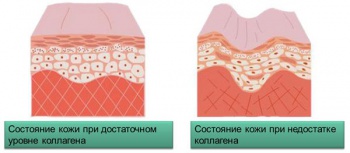 Фото к статье Коллаген для кожи 2.jpg