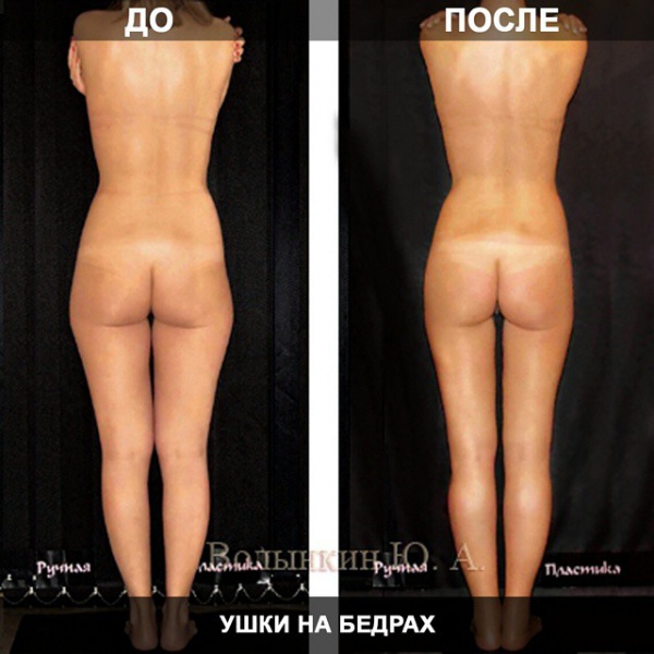 Файл:Rez.jpg