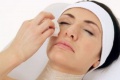Chemical-peel 4.jpg