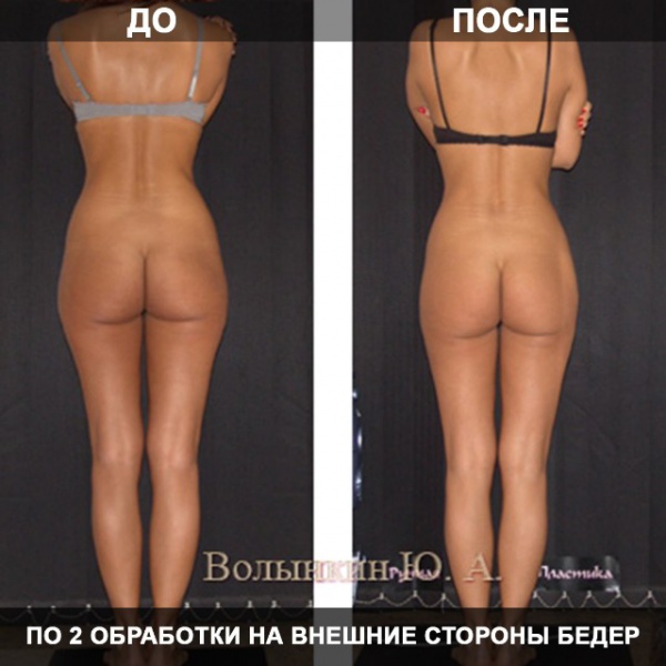 Файл:11142923 1383766831948368 1605823273 n.jpg